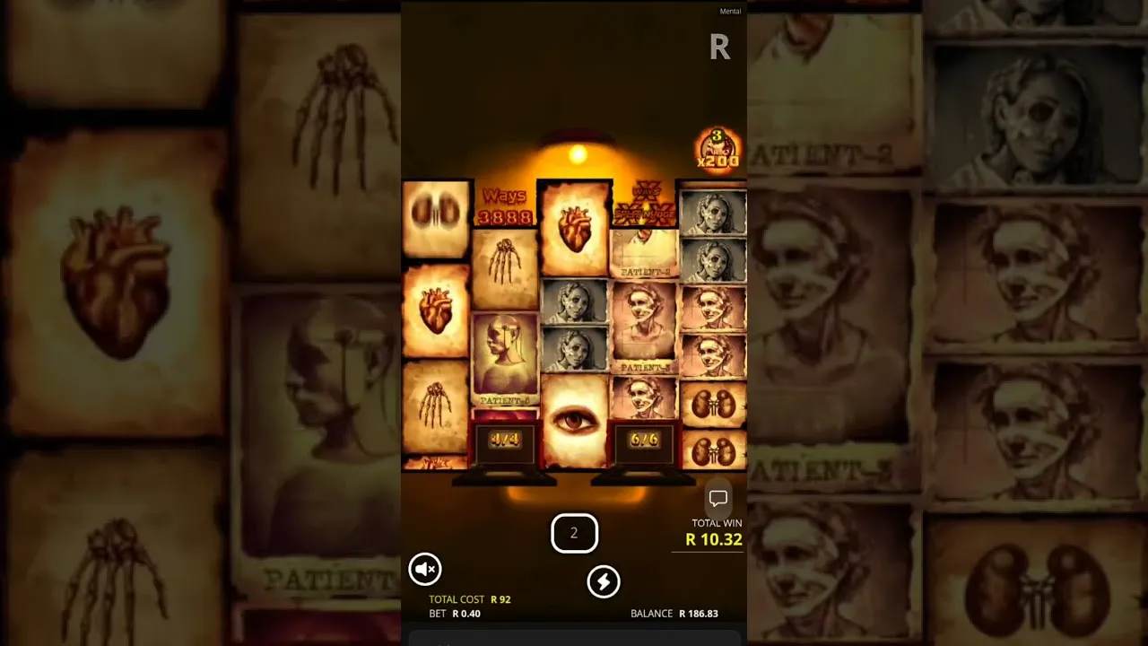 Mental 66666x Big Win: Lobotomy Free Spins